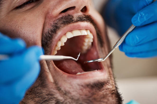 Best Emergency Dental Care for Trauma or Injury in Forest City, IA